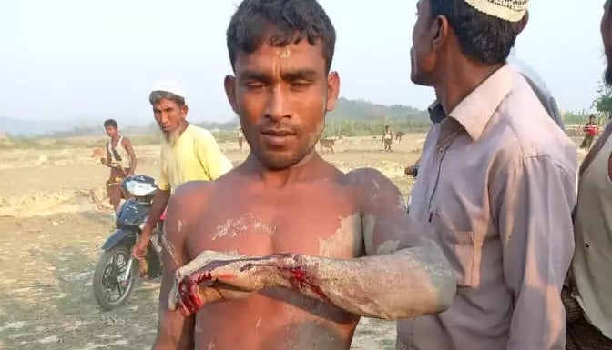 A Rohingya man was hit by bullet